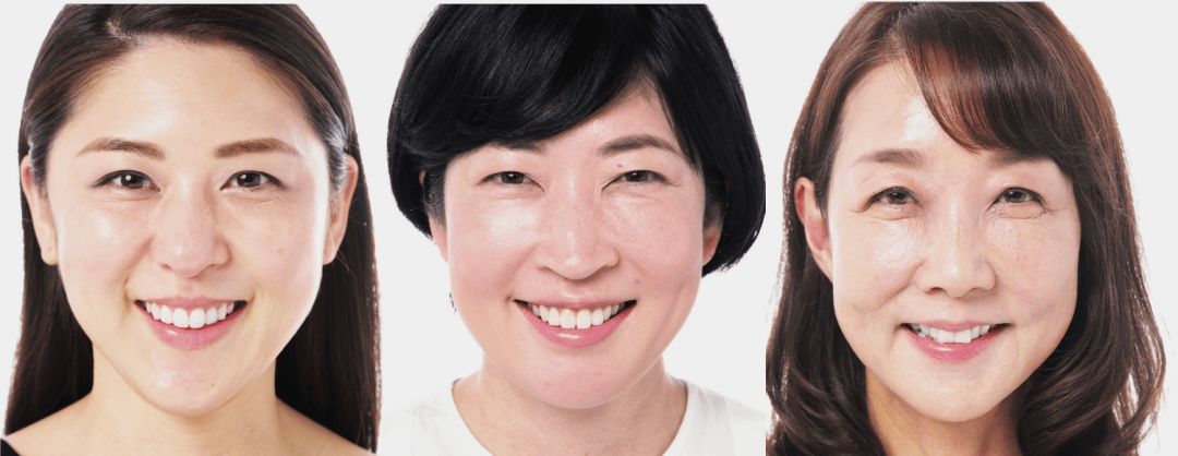醫療美容 | 表情紋、眼周紋、法令紋，針對性改善！
